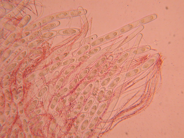 Sarcoscypha jurana... al microscopio